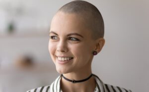 haaruitval door chemotherapie